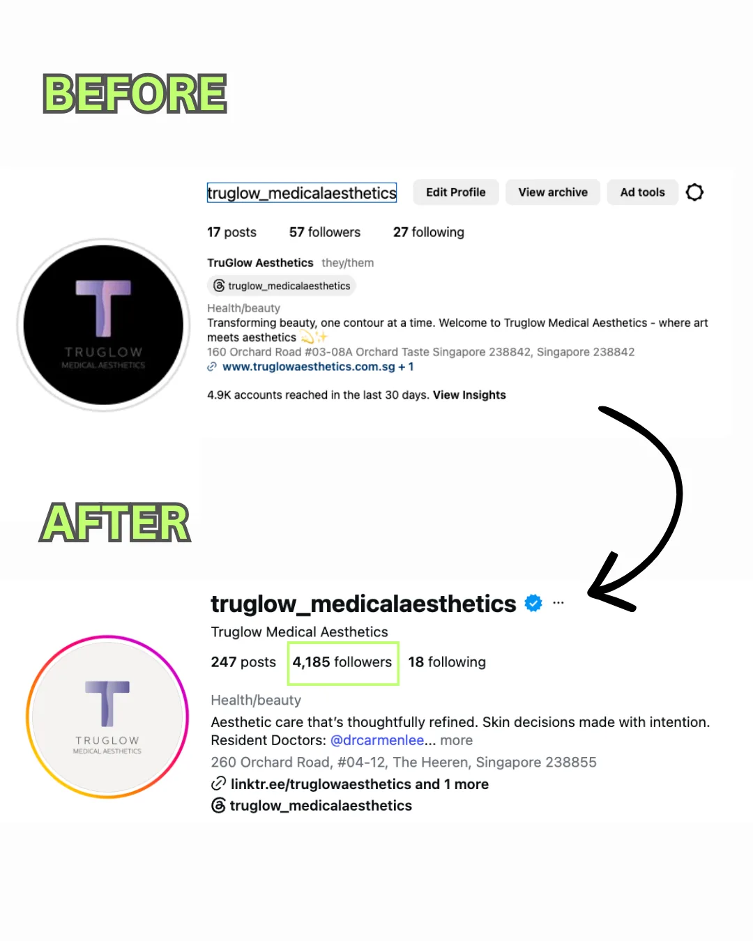 TruGlow Medical Aesthetics Instagram profile before and after: 17 posts and 57 followers, then 247 posts, 4,185 followers, and a verified badge